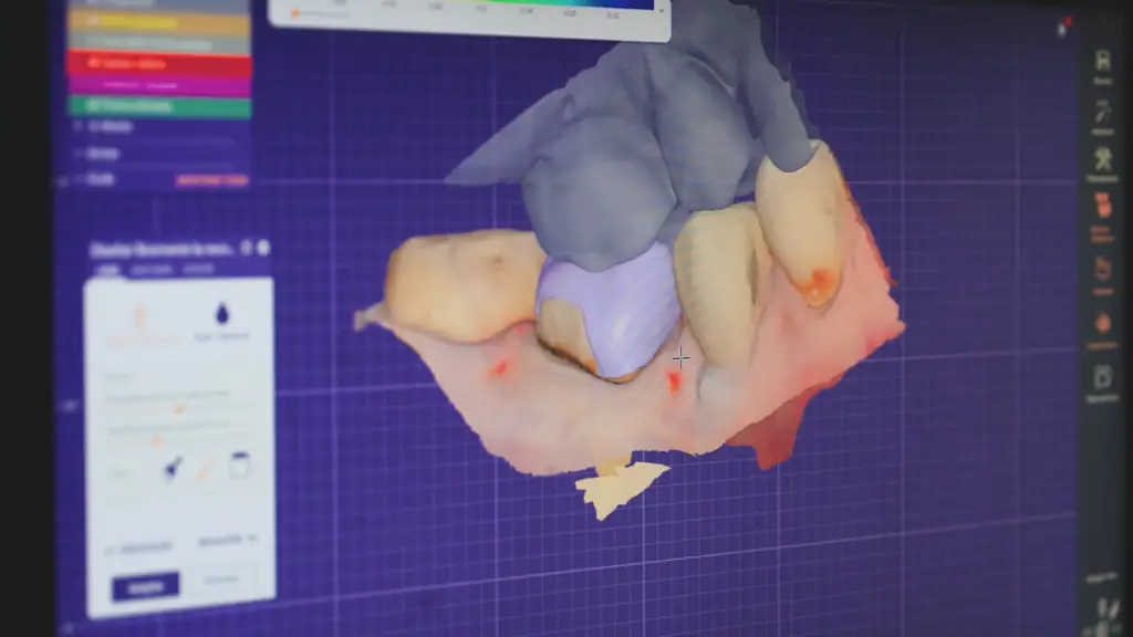 Reconstrucción digital en 3D de una mandíbula en el monitor del box de CPH Salud